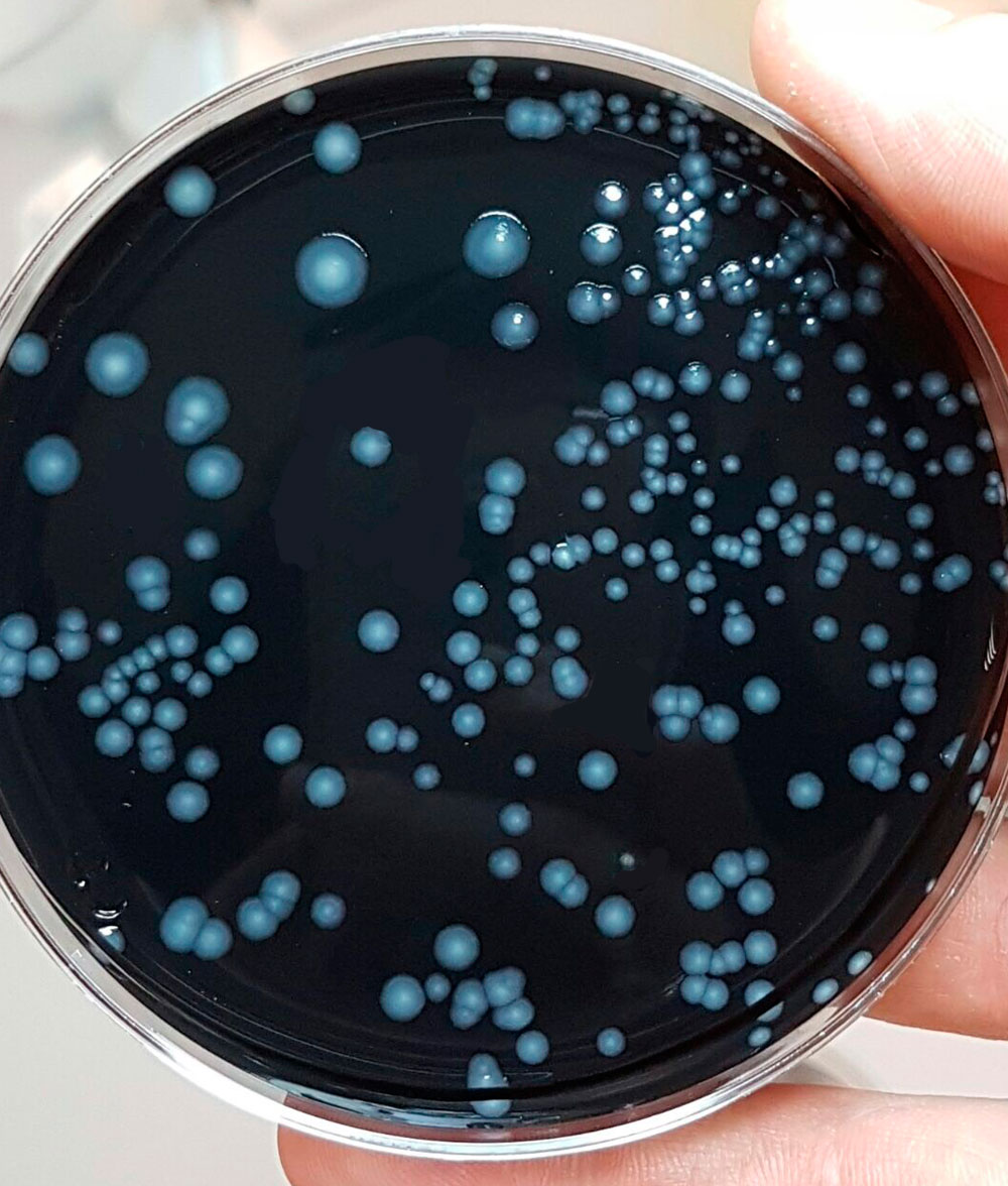 Muestra Legionella