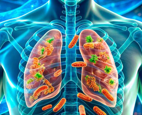 que es la legionella y como se transmite