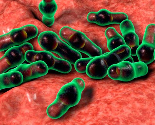 que es clostridium perfringens