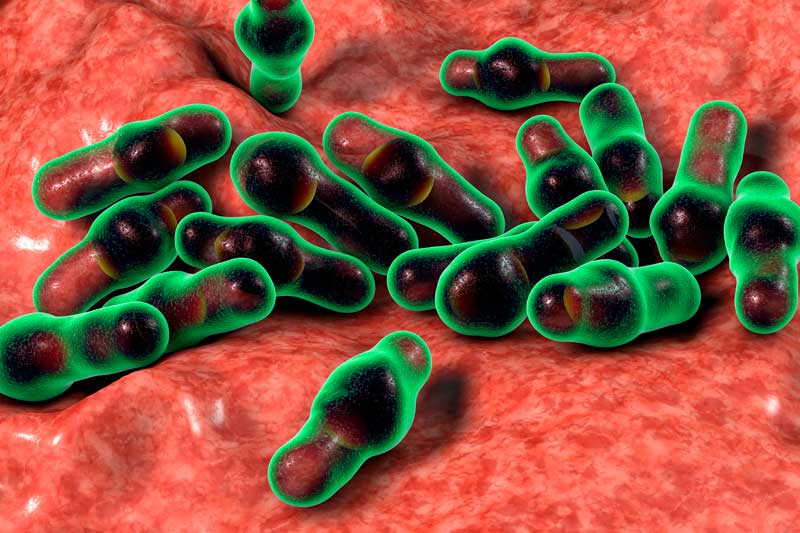 que es clostridium perfringens